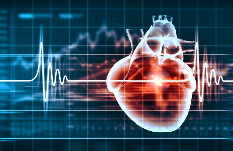 Myocardial Infarction: A Brief Review