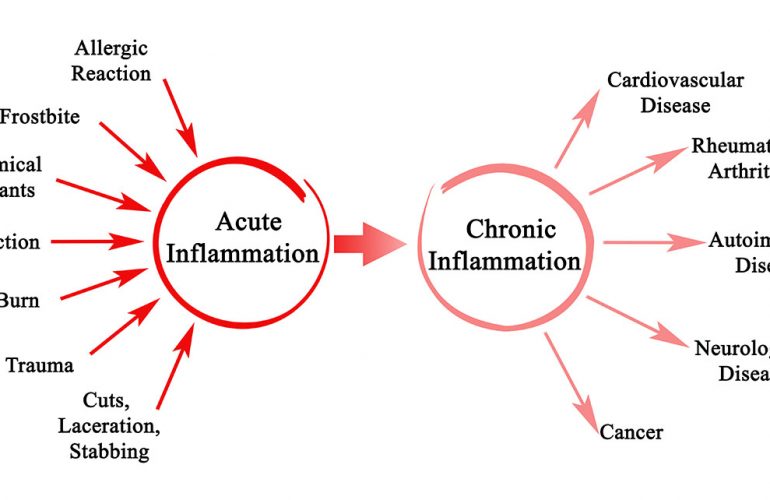 Inflammaging and What It Means for You