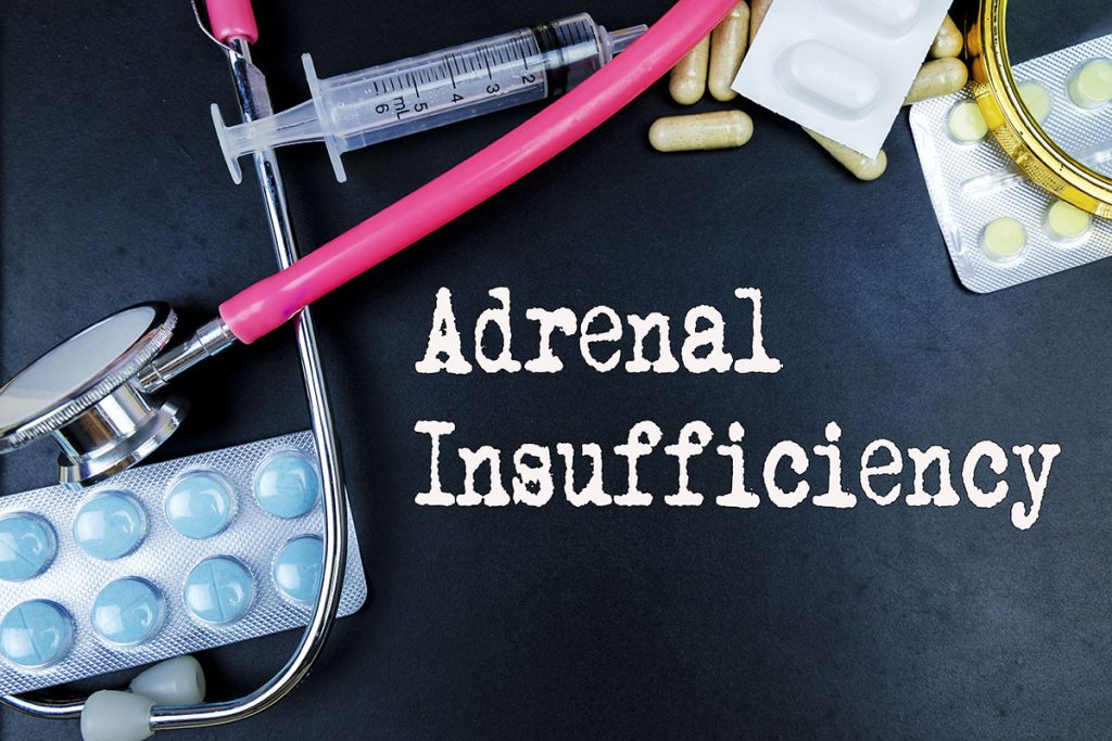 Are You Suffering from Adrenal Fatigue?