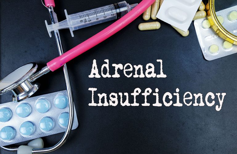 Are You Suffering from Adrenal Fatigue?